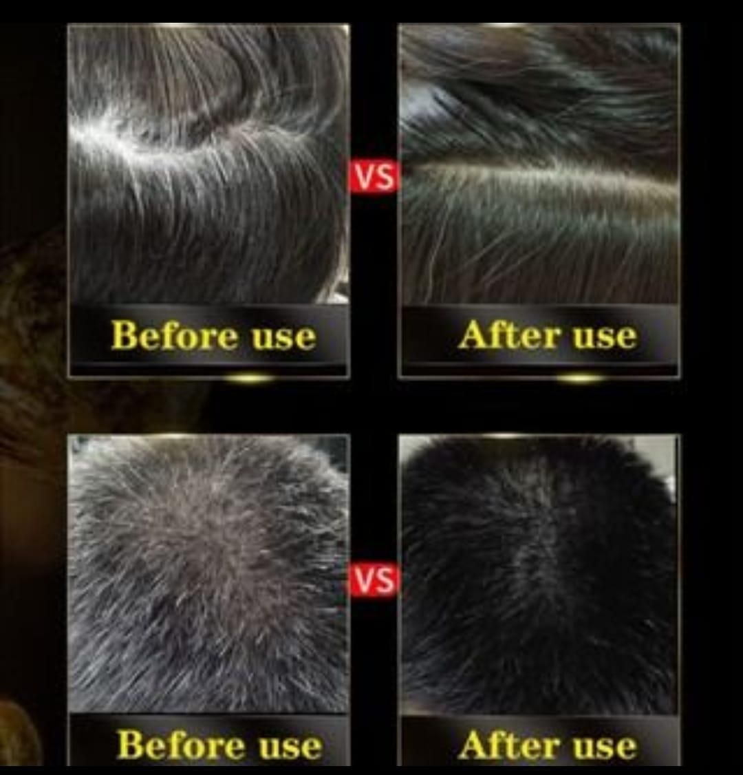 3-IN-1 BLACK HAIR DYE SHAMPOO (AYURVEDIC NO SIDE EFFECT)