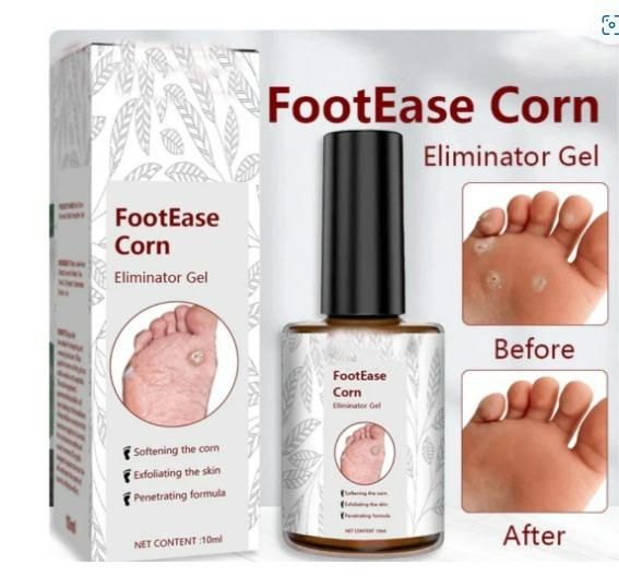 FootEase™ Corn Removal Serum