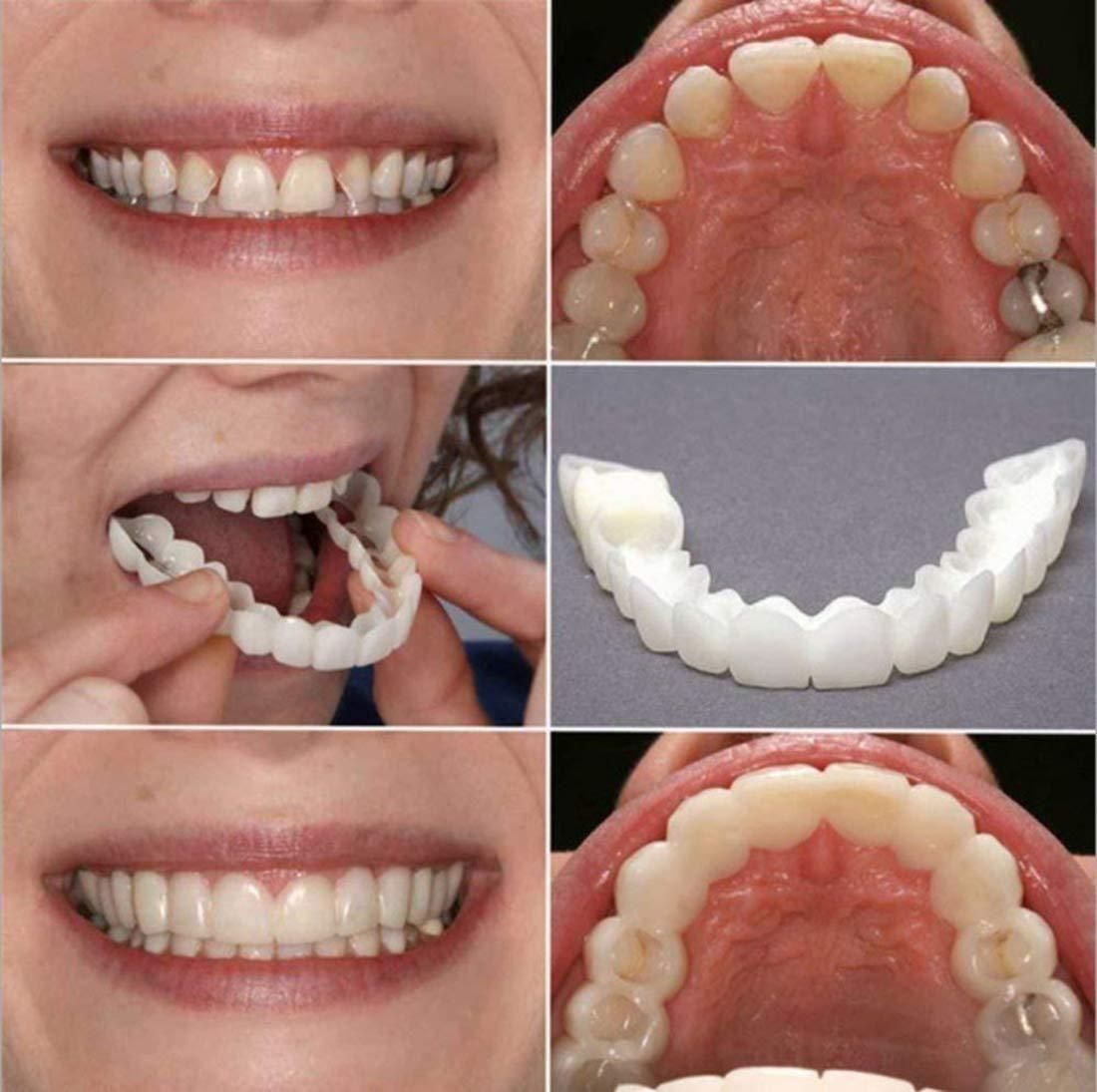 FIT FLEX ADJUSTABLE SNAP-ON DENTURES